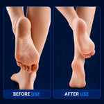 Electric Pedicure Foot File Callus Remover – Rechargeable Foot Care Tool