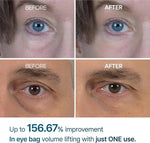 Dr. Melaxin™ Eyephalt Eyecream - Instant Eyebag & Dark Circle Corrector