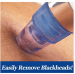 PoreVac Pro™ | USB Rechargeable Blackhead Remover & Deep Pore Cleaner