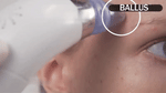 PoreVac Pro™ | USB Rechargeable Blackhead Remover & Deep Pore Cleaner